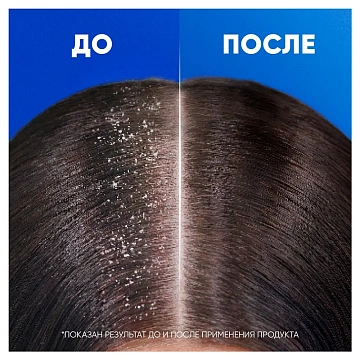 Шампунь-бальзам Head & Shoulders Против перхоти 2в1, 330мл