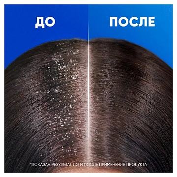 Шампунь Head & Shoulders Основной уход 2в1, 400мл