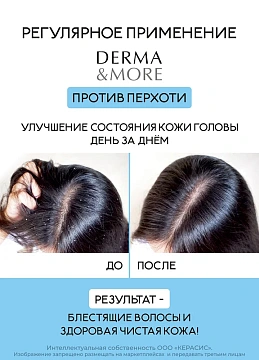 Шампунь Derma & More от перхоти, 600мл